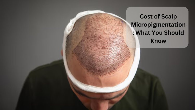 Cost of Scalp Micropigmentation: What You Should Know