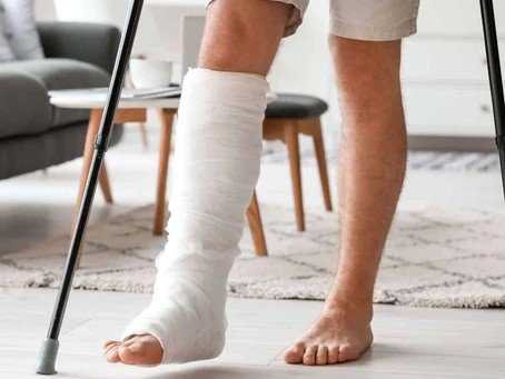 Can a Broken Leg Qualify for Social Security Disability Benefits?