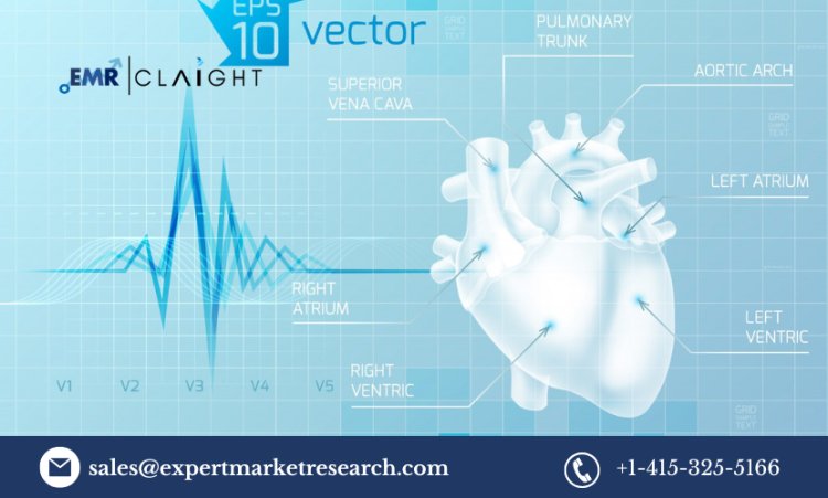 Cardiology Information System Market Trends & Growth Report 2025 - 2034