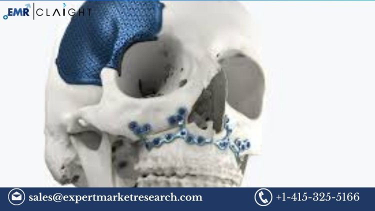 Craniomaxillofacial Implants Market: Growth, Trends, and Forecast (2025-2034)