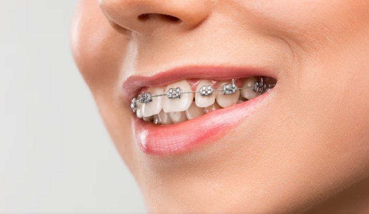 What Are Orthodontic Services? A Dentist’s Perspective