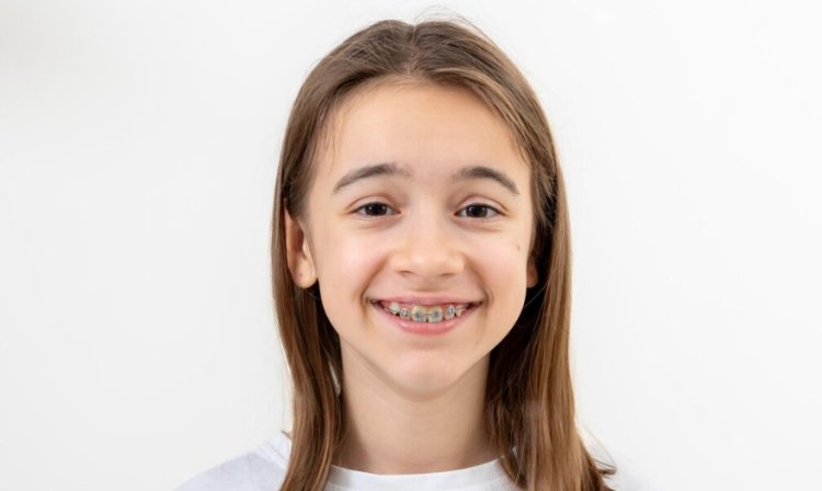 What Are Orthodontic Services