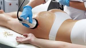 Cellulite Treatment & Body Sculpting in San Diego